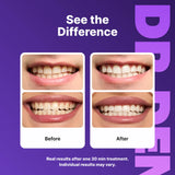 DRDENT Purple Teeth Whitening Strips - 7/21 Whitening Sessions - Non Sensitive Teeth Whitening - Peroxide-Free — image 5